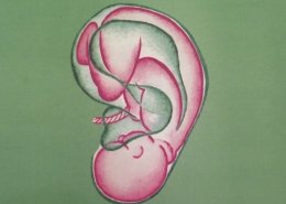 ωτοβελονισμος