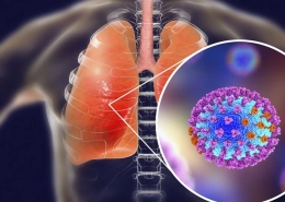 dr-kyriakakiss-gripi-a