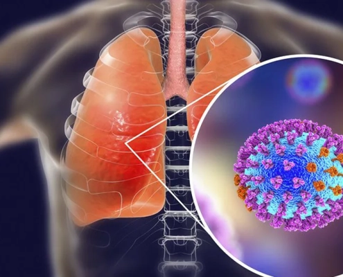 dr-kyriakakiss-gripi-a