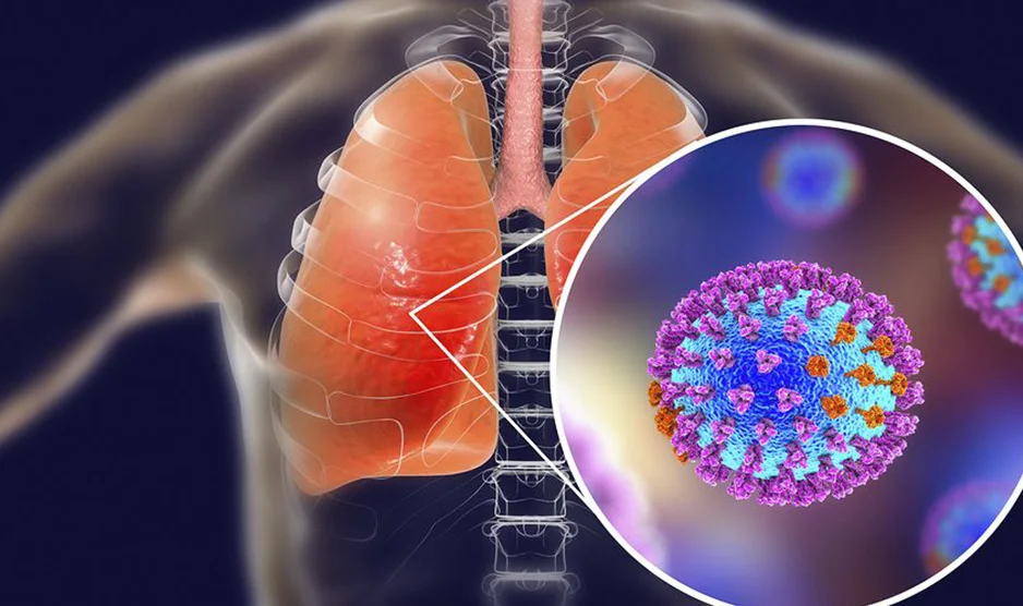 dr-kyriakakiss-gripi-a